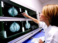 Одинцовская ЦРБ присоединилась к акции «Маммологический скрининг женского населения Московской области»