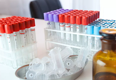 Популяционный иммунитет жителей Одинцовского округа оценят ходе тестирования