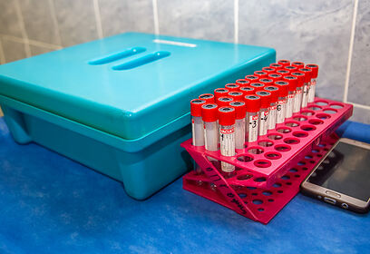 Донорская суббота пройдет в Одинцовской областной больнице 25 апреля