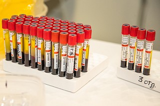 Число выявленных случаев заболевания коронавирусом в Подмосковье снизилось на 15%