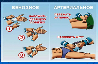 Правила оказания первой помощи пострадавшим от порезов