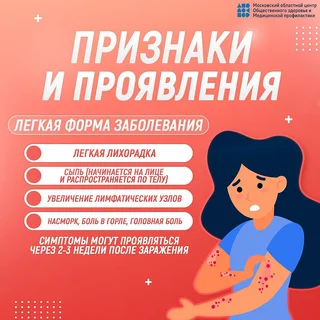 Жителей Одинцовского округа предупреждают об опасности краснухи